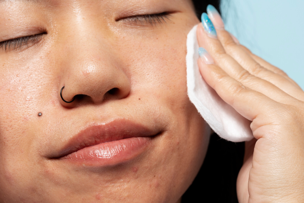 油脂分泌過多會導致毛孔堵塞，形成粉刺